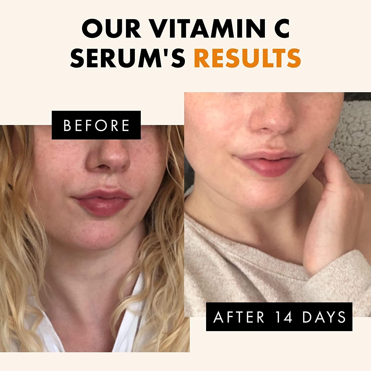 Vitamin C Face Serum - Anti Aging Facial Brightening Serum Hyaluronic Acid Pure Vitamin C Serum for Face Dark Spots